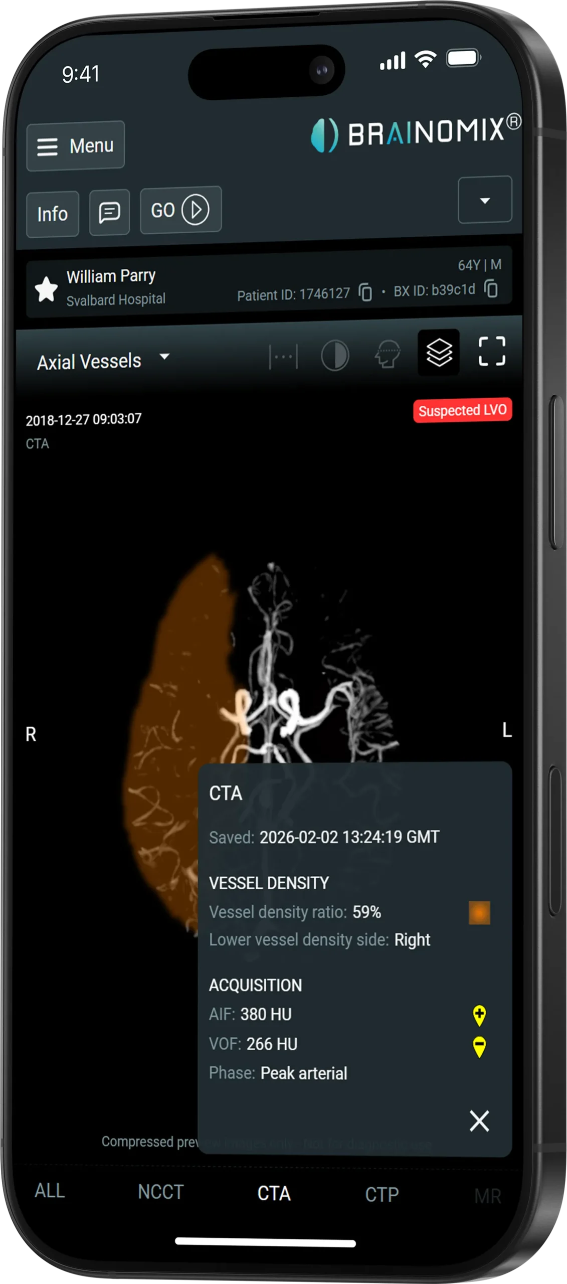 CTA vessel density heatmap and scoring