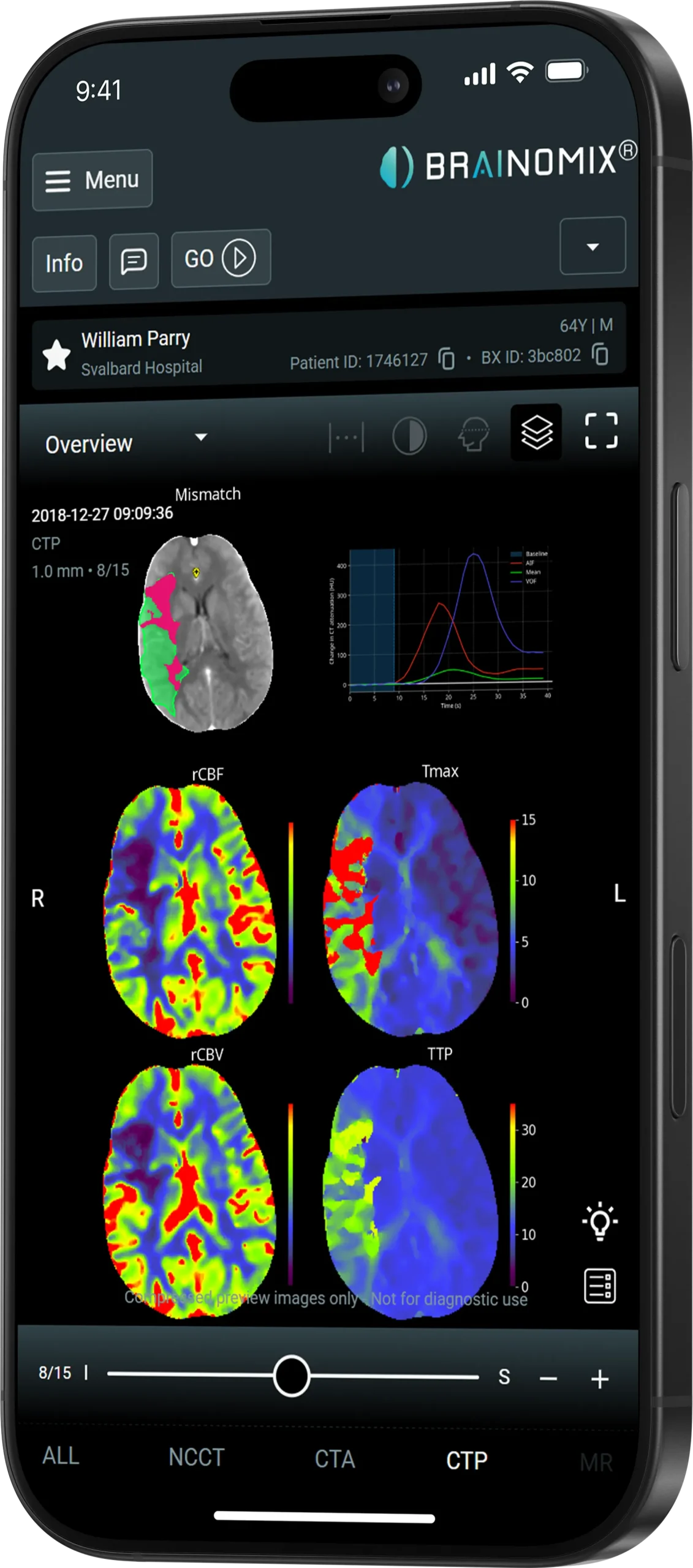 CT perfusion multi-parameter maps