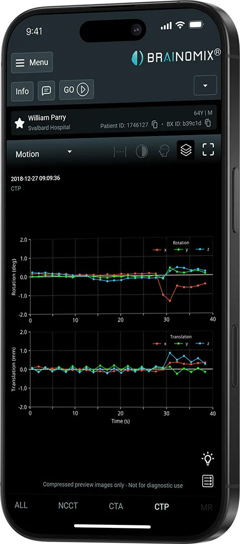 CT perfusion motion correction analysis