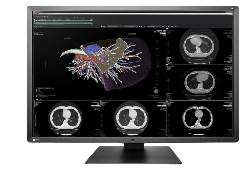 EIZO medical display for diagnostics and examinations