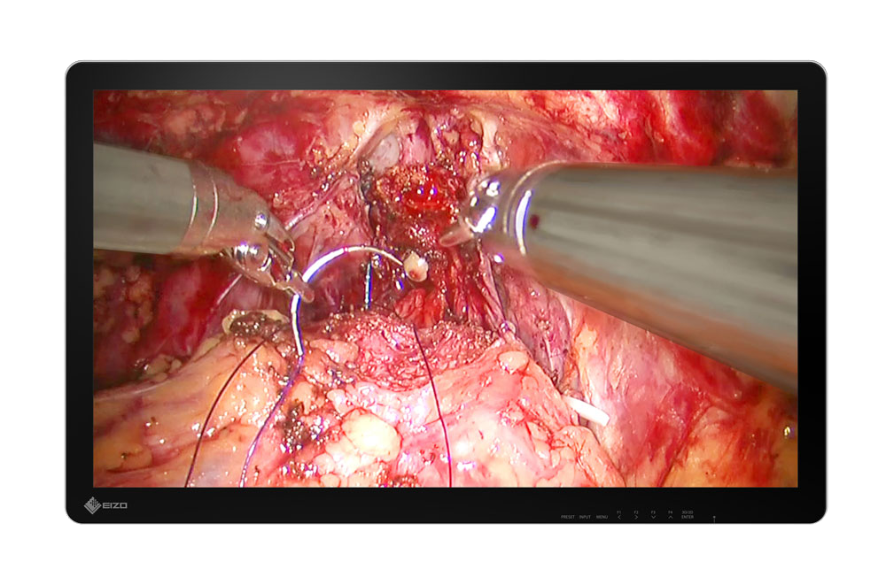 EIZO medical display for treatment and surgery